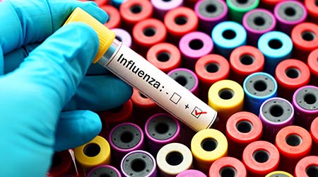 Blood sample positive with influenza virus